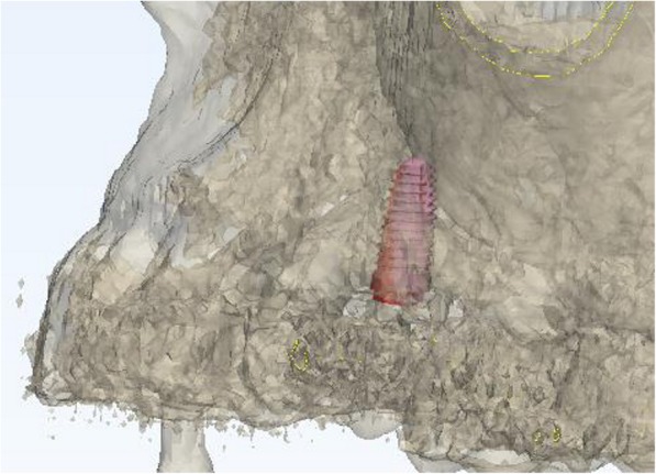 Fig. 8