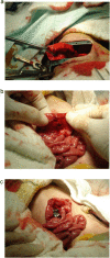 Fig. 2
