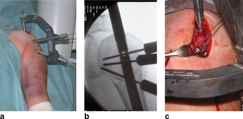 Fig. 2