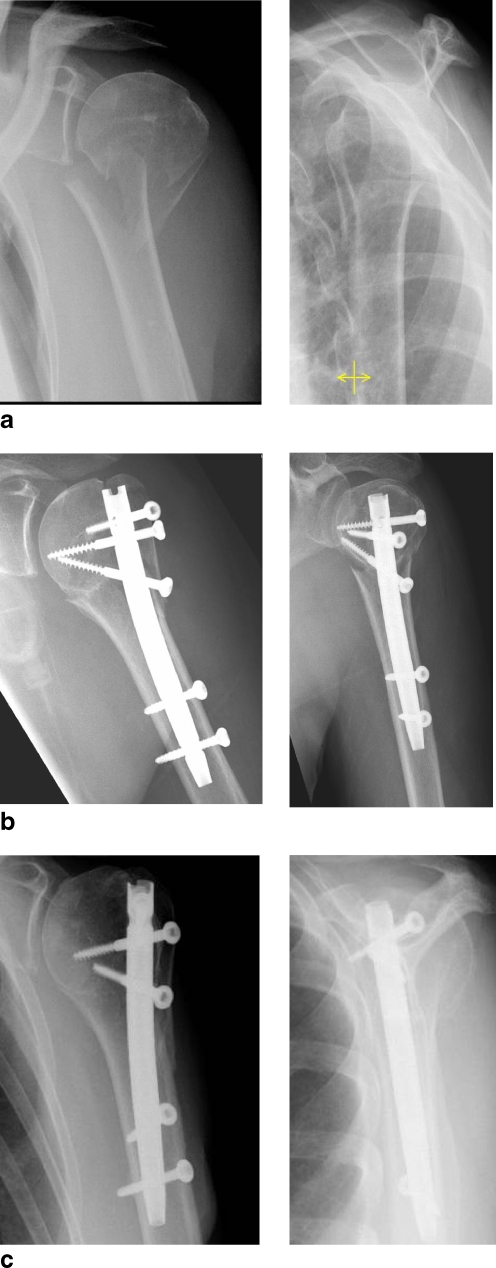 Fig. 3