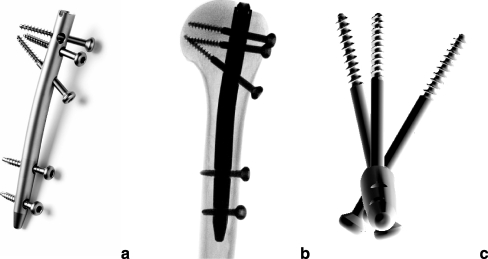 Fig. 1