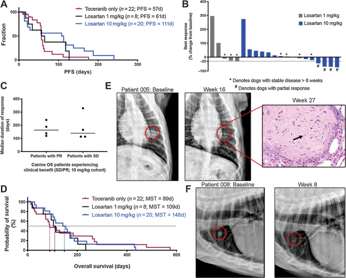 Figure 4. High-dose losartan results in objective responses in dogs with metastatic OS. A, Kaplan–Meier curve comparing PFS in dogs treated with either single-agent toceranib (n = 22), low-dose losartan (1 mg/kg) + toceranib (n = 8), or high-dose losartan (10 mg/kg) + toceranib (n = 20). Log rank test for trend P = 0.058. B, Best responses to losartan–palladia combination therapy, as determined by RECIST criteria (shown as % change from baseline) for dogs that remained on study for at least one cycle of repeat thoracic radiographs. *, Dogs with stable disease; #, dogs experiencing a partial response. C, Median duration of response for those dogs experiencing clinical benefit (stable disease or partial response) in the high-dose losartan (10 mg/kg) cohort. D, Kaplan–Meier curve comparing overall survival in dogs treated with either single-agent toceranib (n = 22), low-dose losartan (1 mg/kg) + toceranib (n = 8), or high-dose losartan (10 mg/kg) + toceranib (n = 20). Log-rank test for trend P = 0.84. E and F, Baseline versus 16- and 8-week posttreatment thoracic radiographs, respectively, of two patients in the 10 mg/kg high-dose losartan cohort experiencing partial regression of pulmonary metastases. Both dogs experienced an ∼70% reduction in the sum diameter of their target lesions. For the patient shown in E, this response was initially noted at week 8, remained stable to further reduced at weeks 16 and 24, and no grossly visible OS pulmonary metastases were evident on necropsy of this patient at 27 weeks post treatment. Only a single residual poorly cellular, matrix-rich microscopic metastasis (shown at right), with individual tumor cell necrosis (arrows), was observed in the lung.