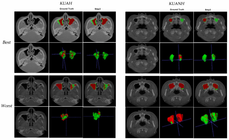 Figure 4