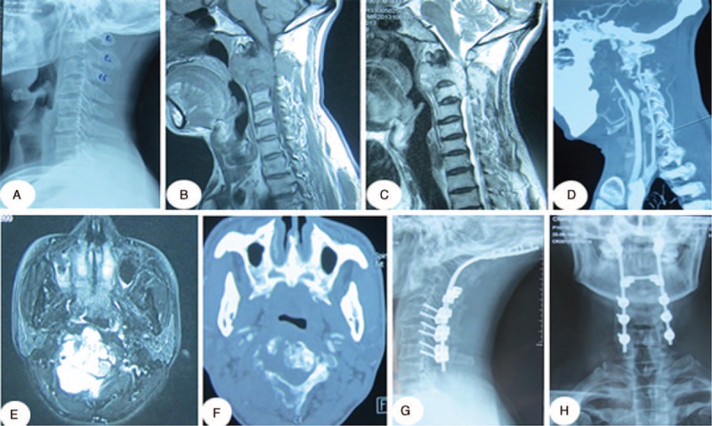 FIGURE 3