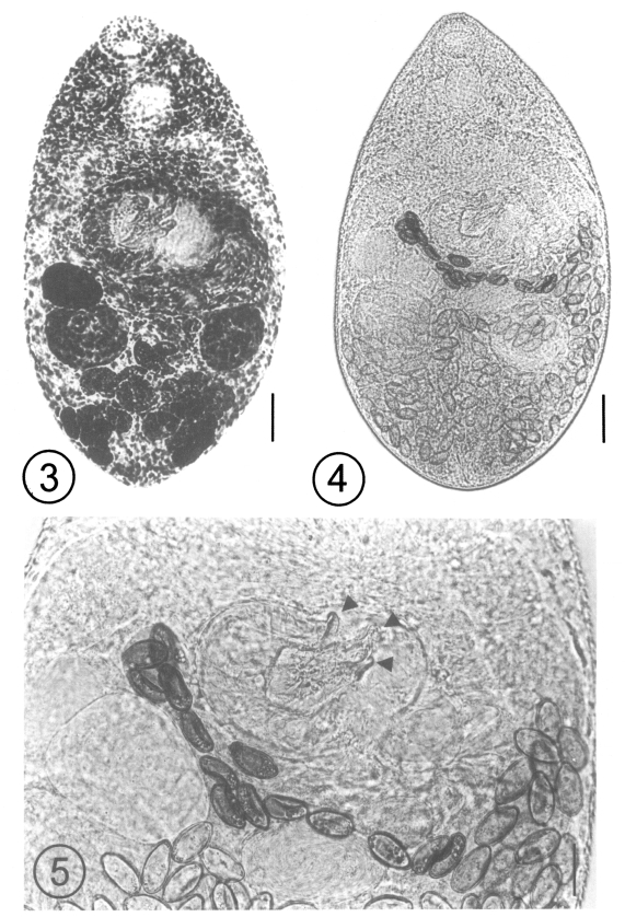 Figs. 3-5