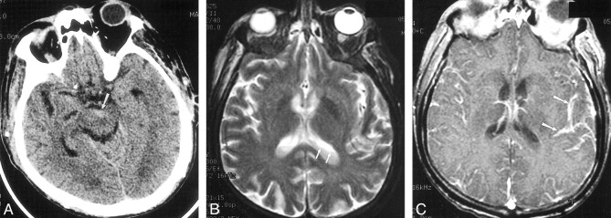 fig 3.