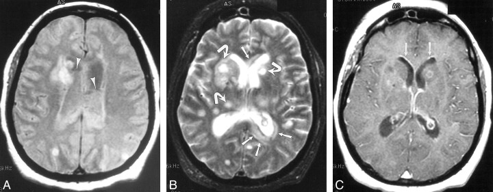 fig 2.