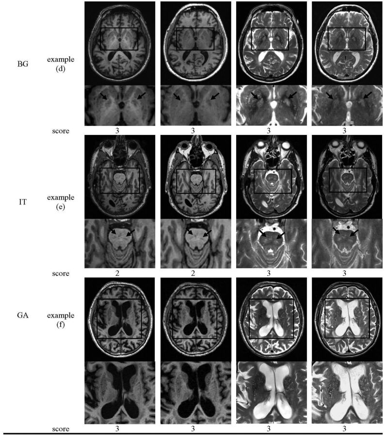 Fig 1.