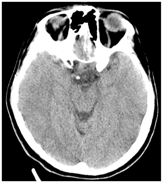 Fig. 2