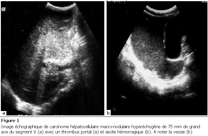 Figure 1: