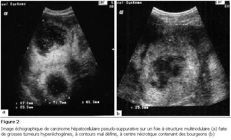 Figure 2: