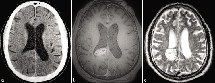 Figure 1: