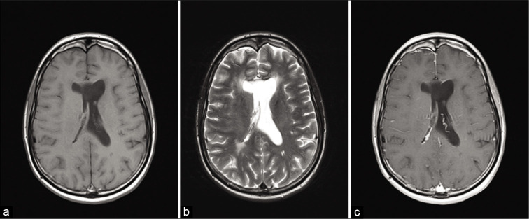 Figure 2: