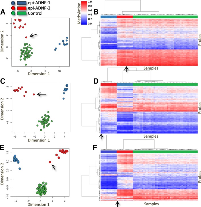 Gene domain-specific DNA methylation episignatures highlight distinct ...