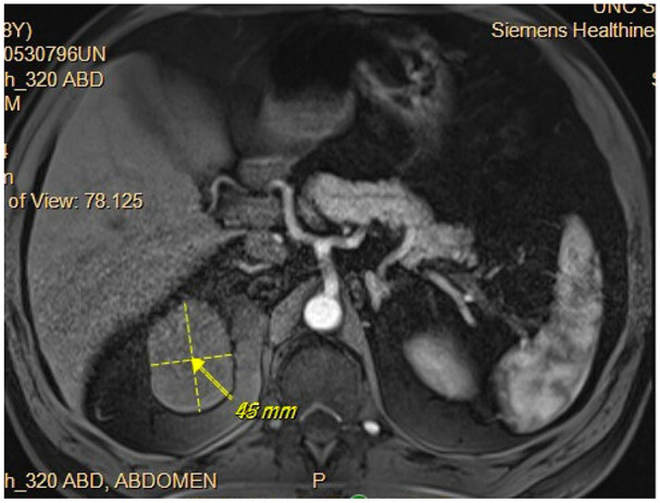 Figure 3.