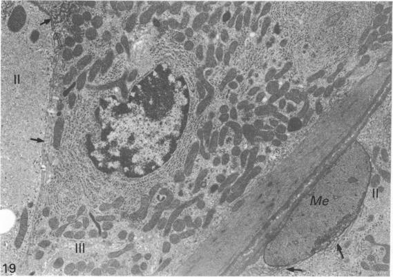 Fig. 19