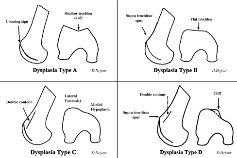 Fig. 2