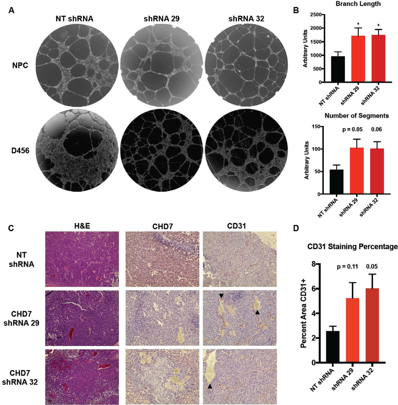 CHD7 is Suppressed in the Perinecrotic/Ischemic Microenvironment and is ...