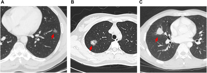 FIGURE 2