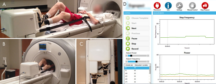 A, Photograph shows the participant set-up for the MRI-compatible exercise stepper. The participant is attached to the stepper with boots with hook and loop fastener straps. A chest harness connected to the stepper minimizes bulk motion during exercise. The strap lengths can be altered to adjust the participant’s positioning on the table. B, Photograph shows the participant exercising in MRI bore. C, Photograph of the frontal view of the stepper shows the dynamic range of stepper pedals. D, Screenshot of monitoring software shows the real-time measurements of step frequency and power during exercise.