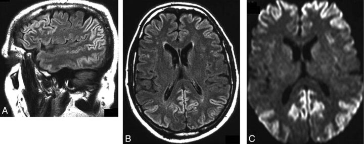 Fig 2.