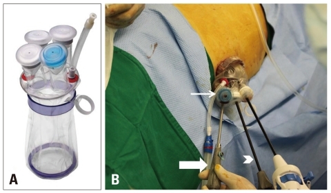 Fig. 1