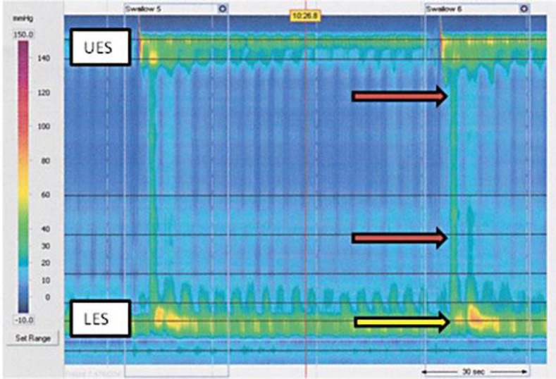 Fig. 2