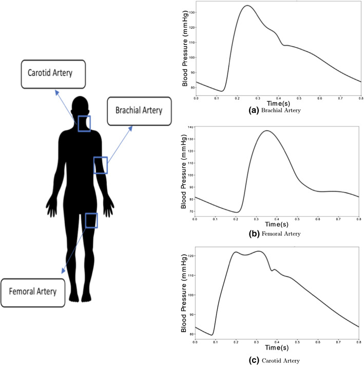 Fig. 11