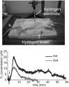 Fig. (2). Measurement of the accumulation of H<sub>2</sub> in rat liver.