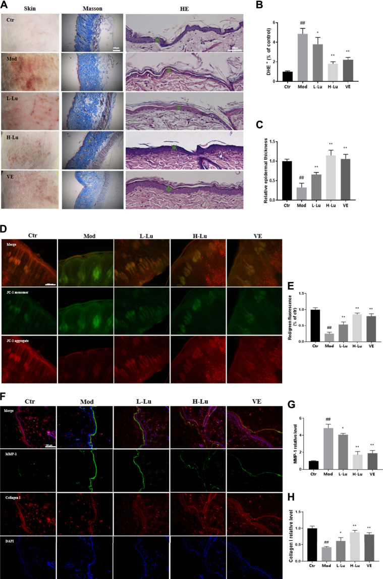 FIGURE 1