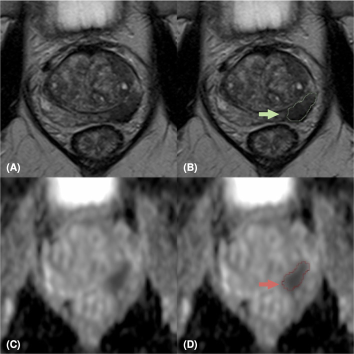 Figure 3