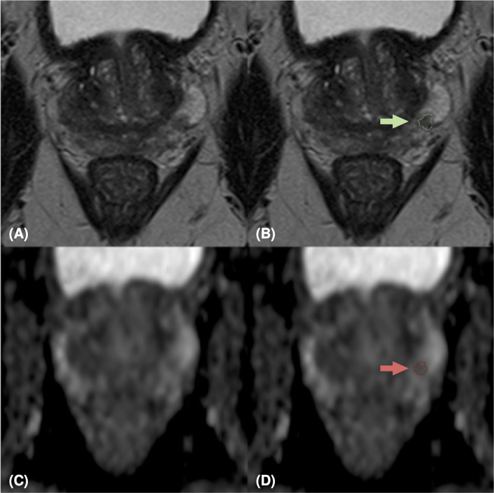 Figure 2