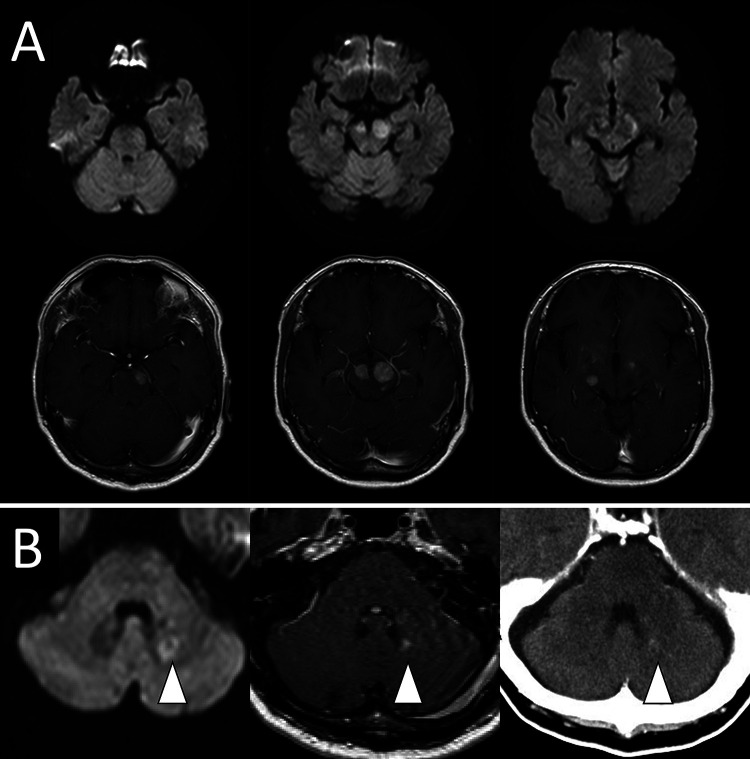 FIG. 1.