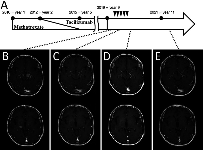 FIG. 4.