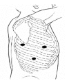 [Table/Fig-1]: