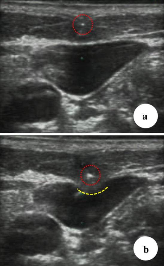 Fig. 5