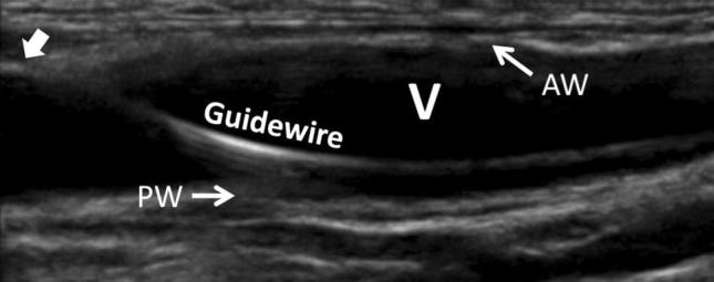 Fig. 11