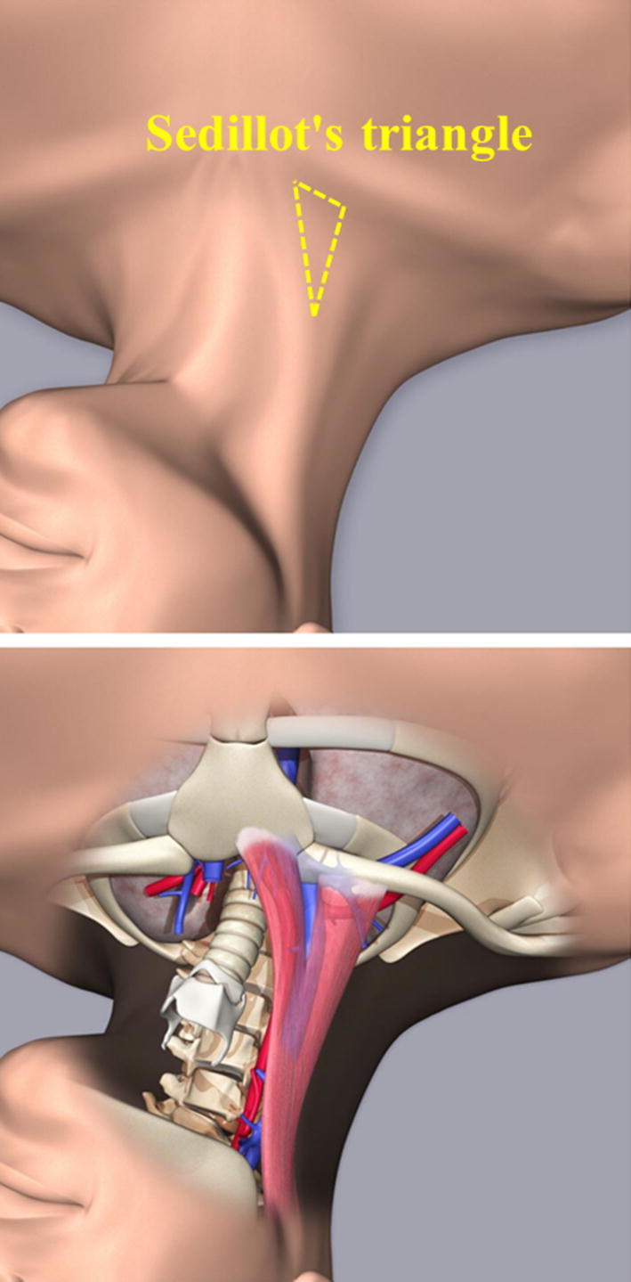 Fig. 1