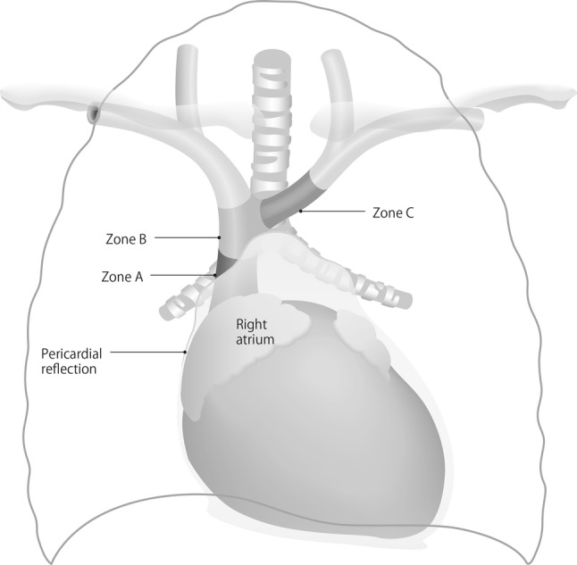 Fig. 12