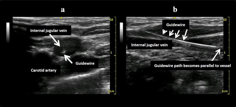 Fig. 15