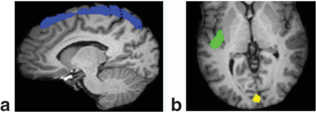 FIG. 5