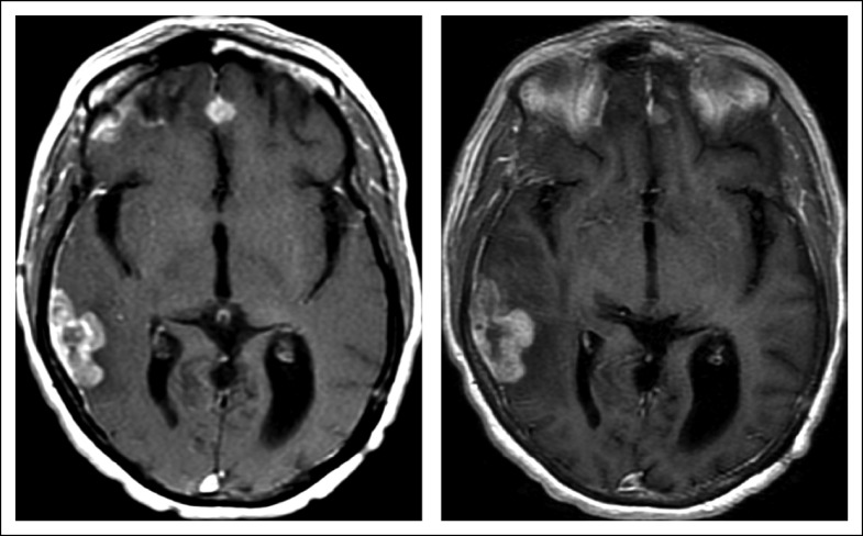 FIG 2.