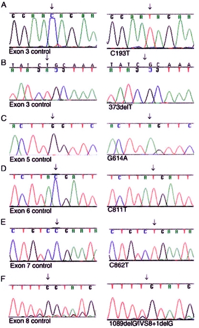 Figure  5