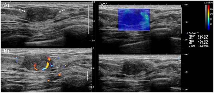 Fig 3