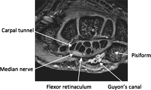 Fig. 8
