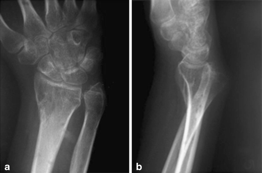 Fig. 12