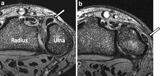 Fig. 9