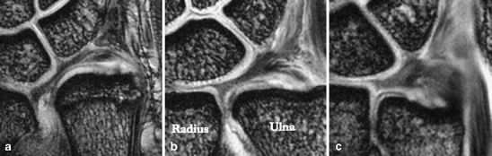 Fig. 6