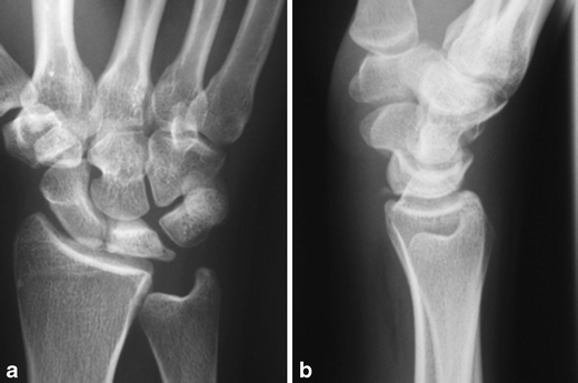 Fig. 13