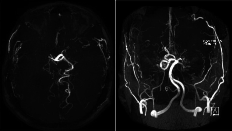 Fig. 2